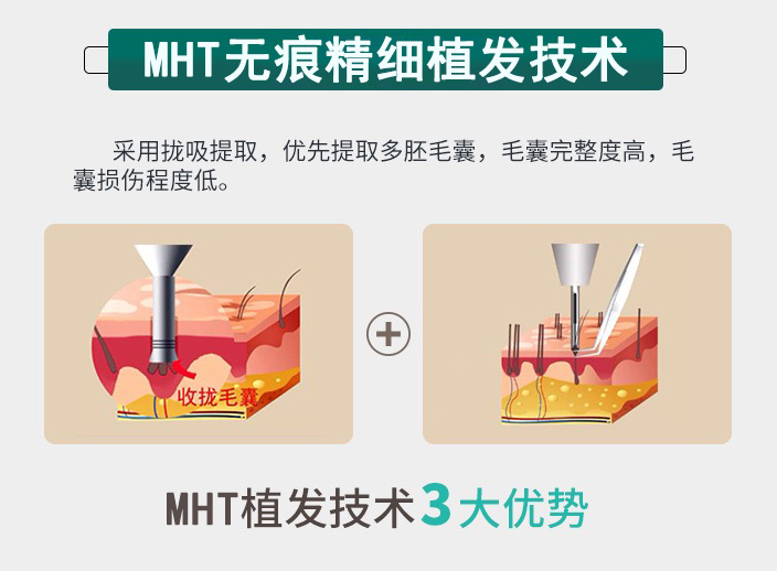 MHTo۾ֲlg